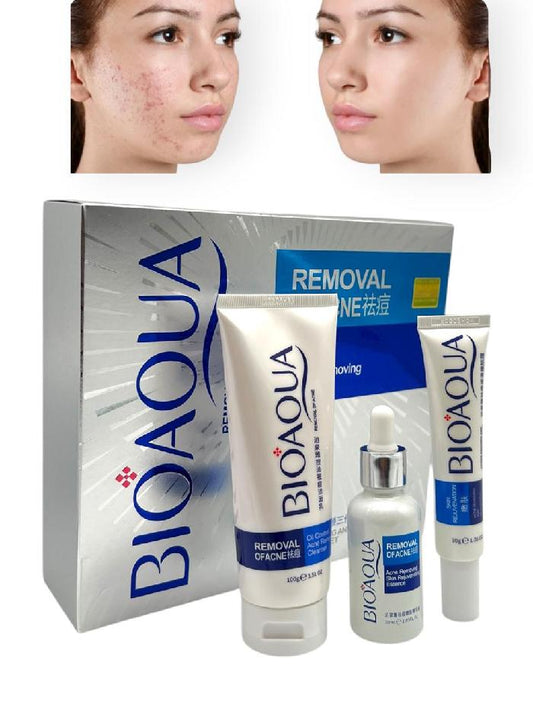 Kit Premium de Cuidado Facial Antiacné – 3 Piezas (Jabón + Sérum + Crema) Bioaqua