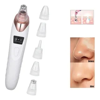 Extractor De Espinillas Y Puntos Negros